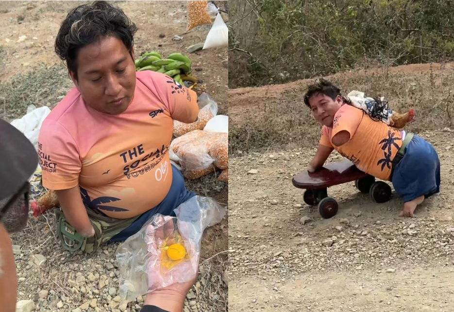 Jonatan, 34 anos — Trabalha se arrastando para não desistir 